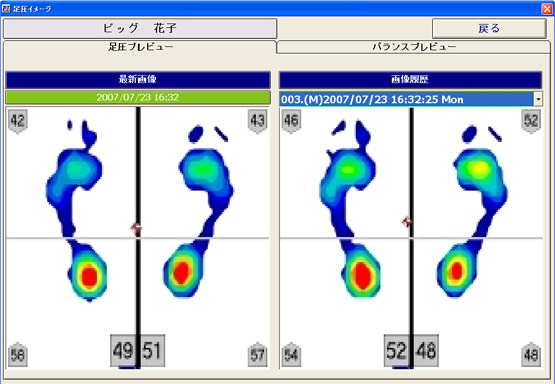 足圧分布表示