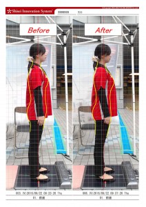beforeafter